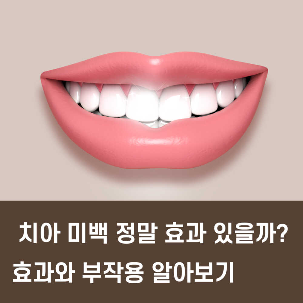 치아미백 효과와 부작용