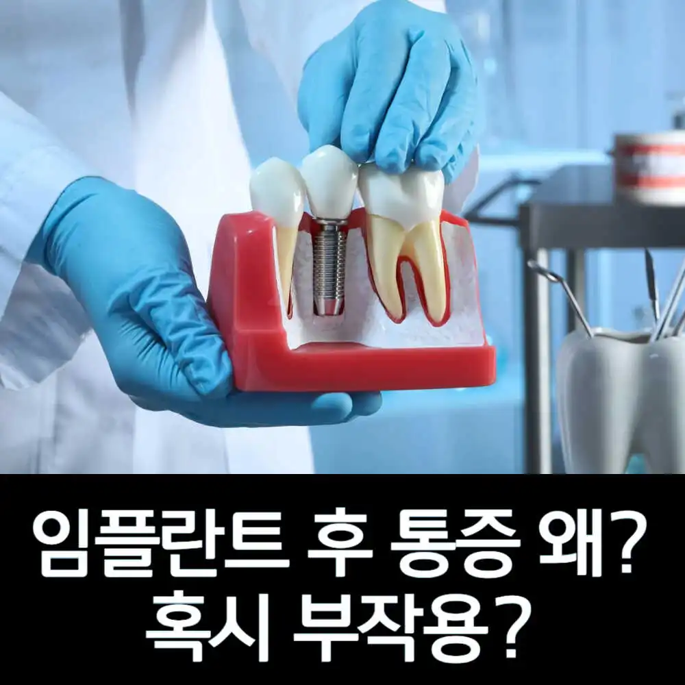 임플란트 후 통증